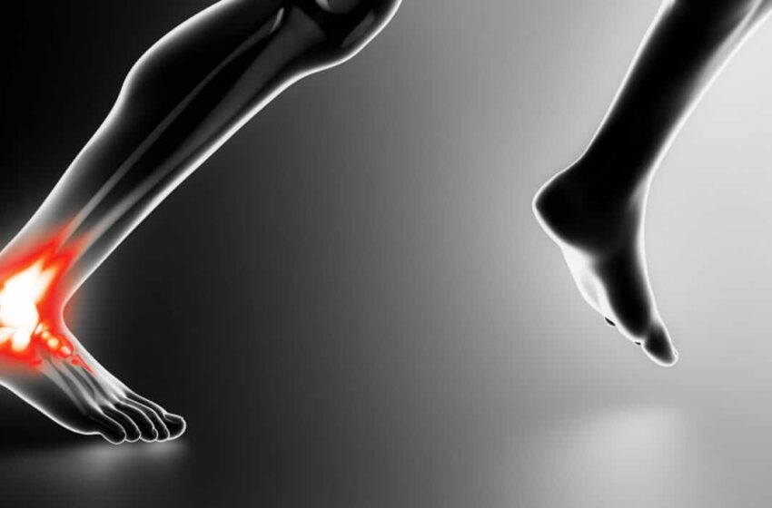  Rupture du tendon d’Achille: Causes et symptômes