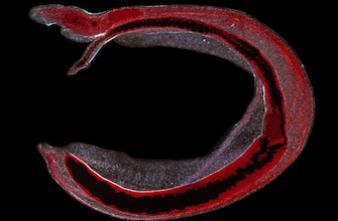  Bilharziose : Un fléau millénaire à la lumière de la génétique